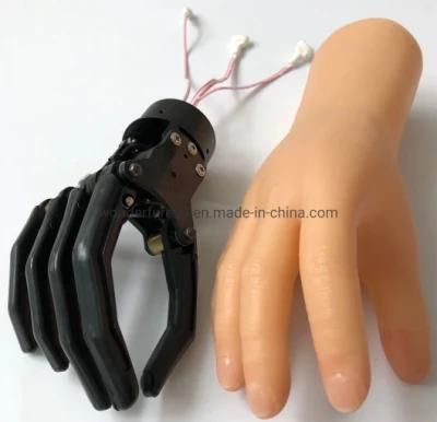 Myoelectric Control Prostheses with One Degree of Freedom for Adults
