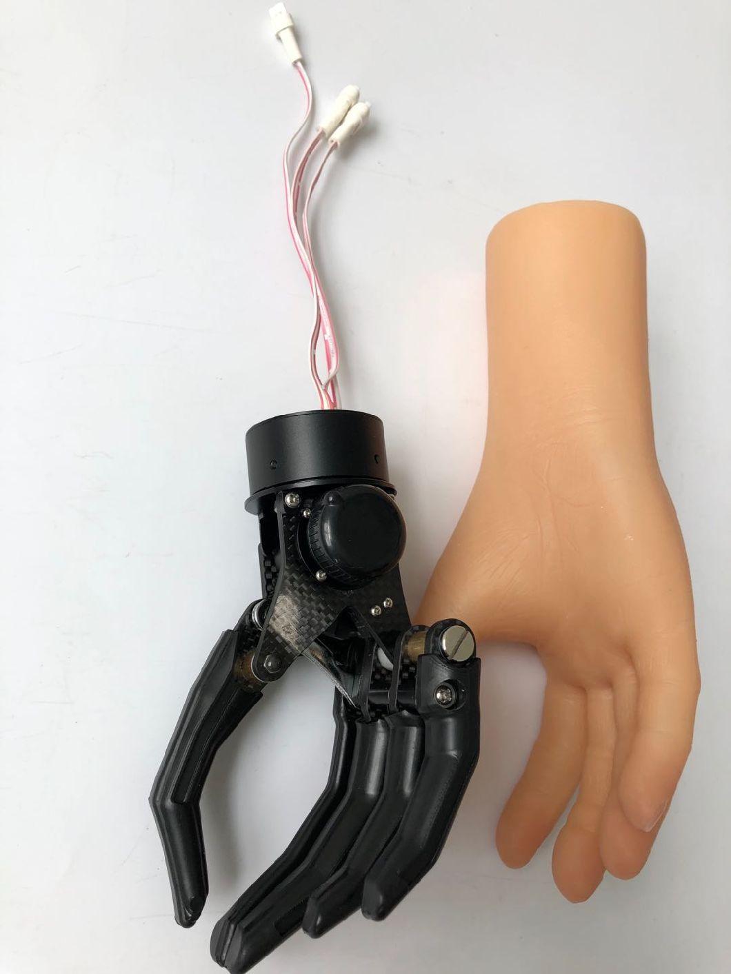 Prosthetic Components Artificial Carbon Fiber Myoelectric Control Hand