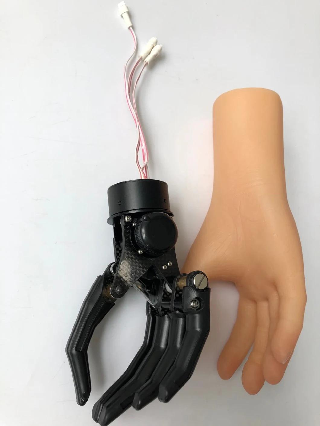 Myoelectric Control Prostheses with One Degree of Freedom for Adults