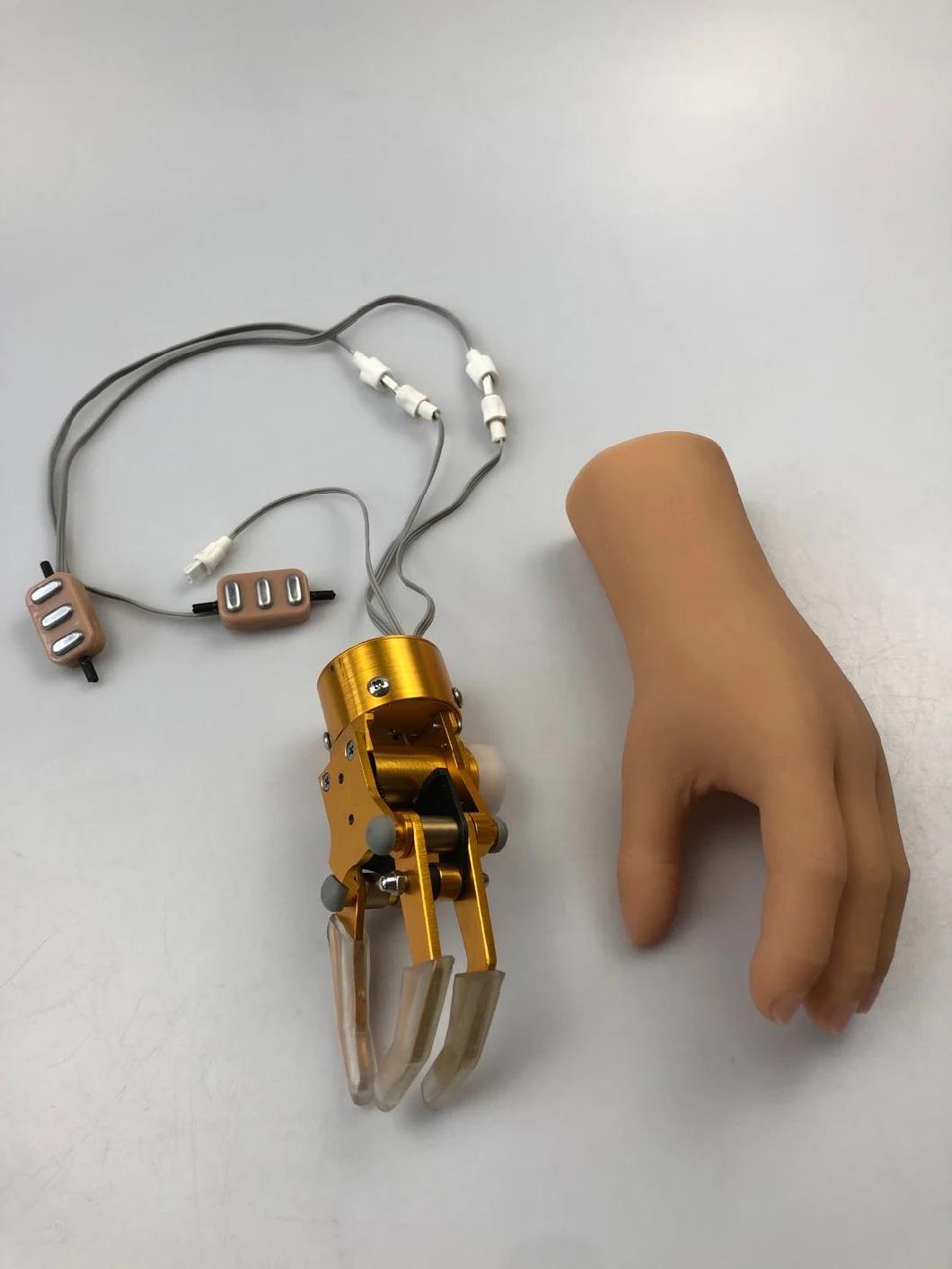 Prosthetic Components Myoelectric Control Hand for Children