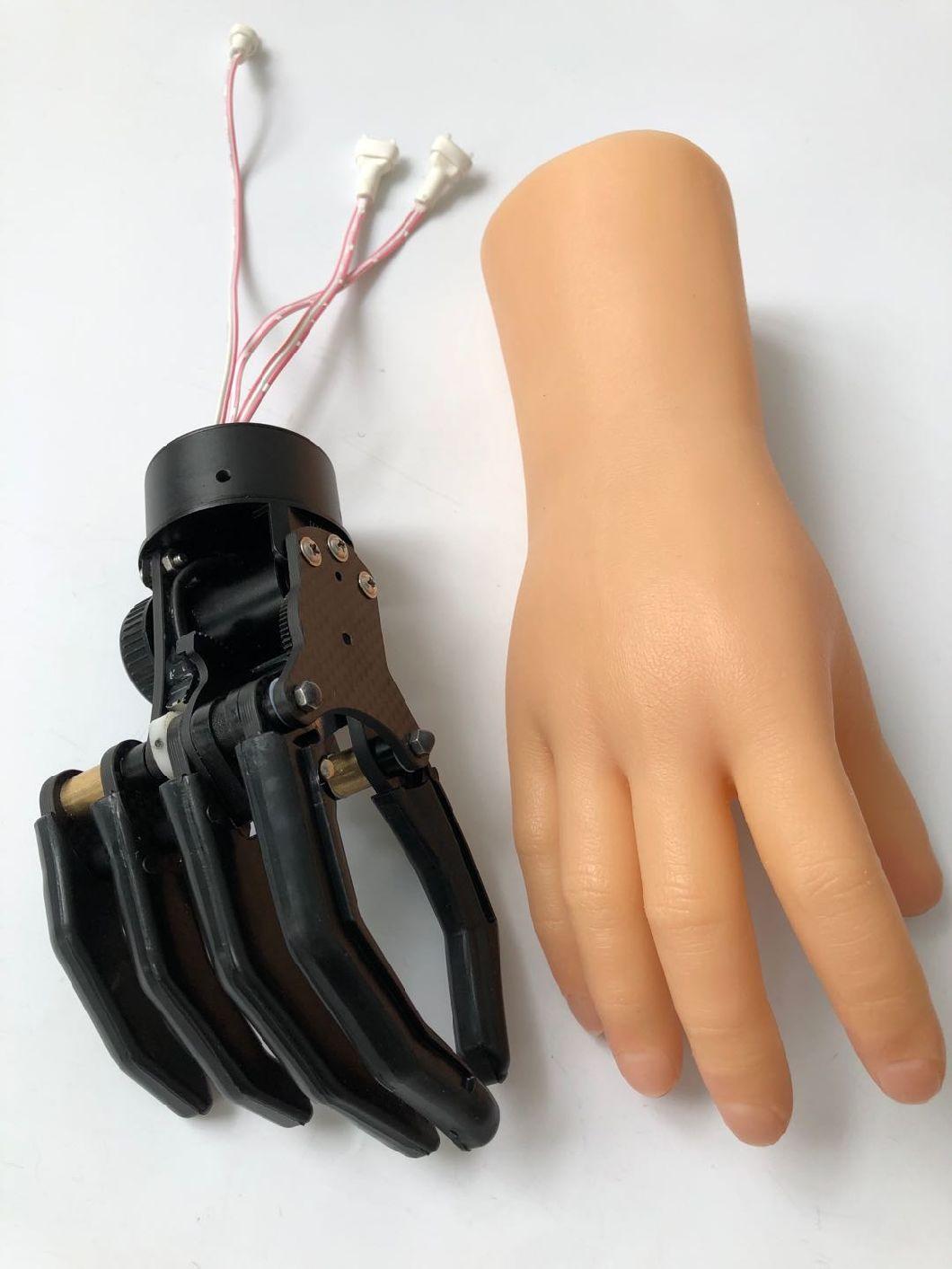 Prosthetic Components Artificial Carbon Fiber Myoelectric Control Hand